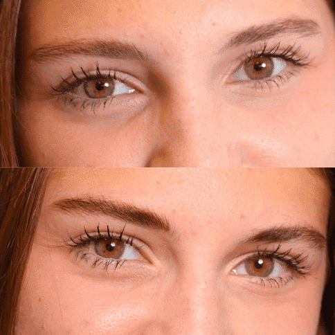 before and after dying with godefroy