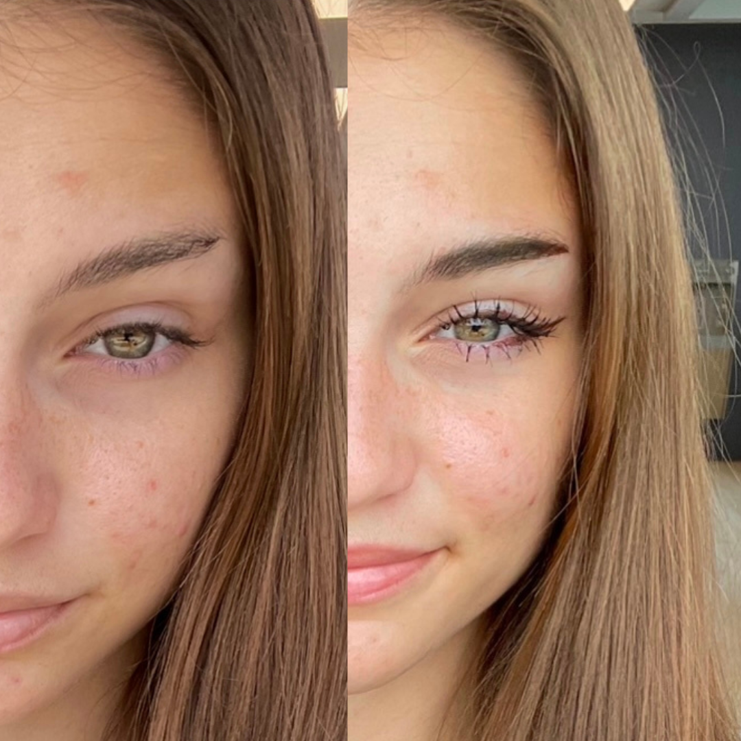 girl with eyebrow slit before and after dying