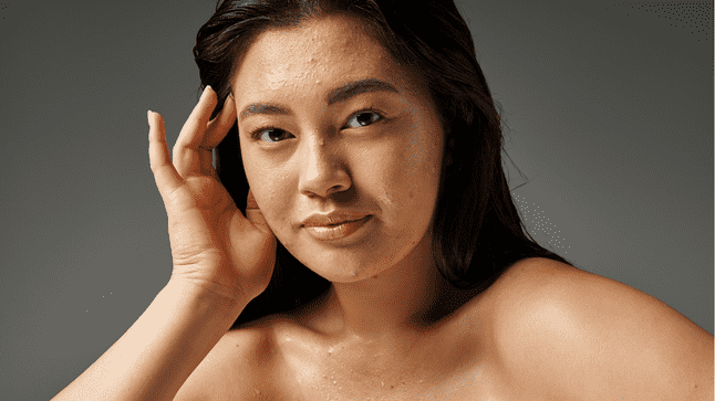 Woman with posing with textured skin