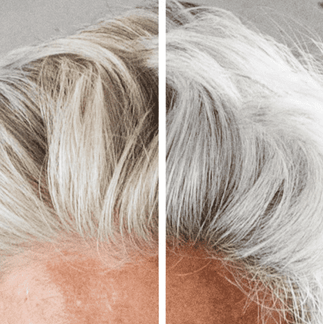 Before and after of using Silver Fox shampoo