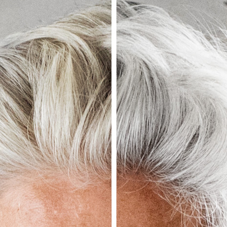 Before and after of using Silver Fox shampoo 