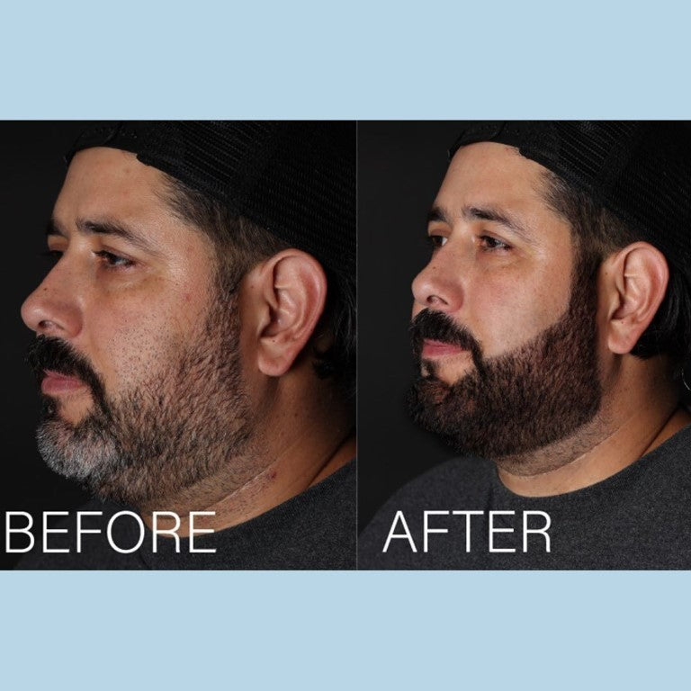 Before and after for beard tint (jose)